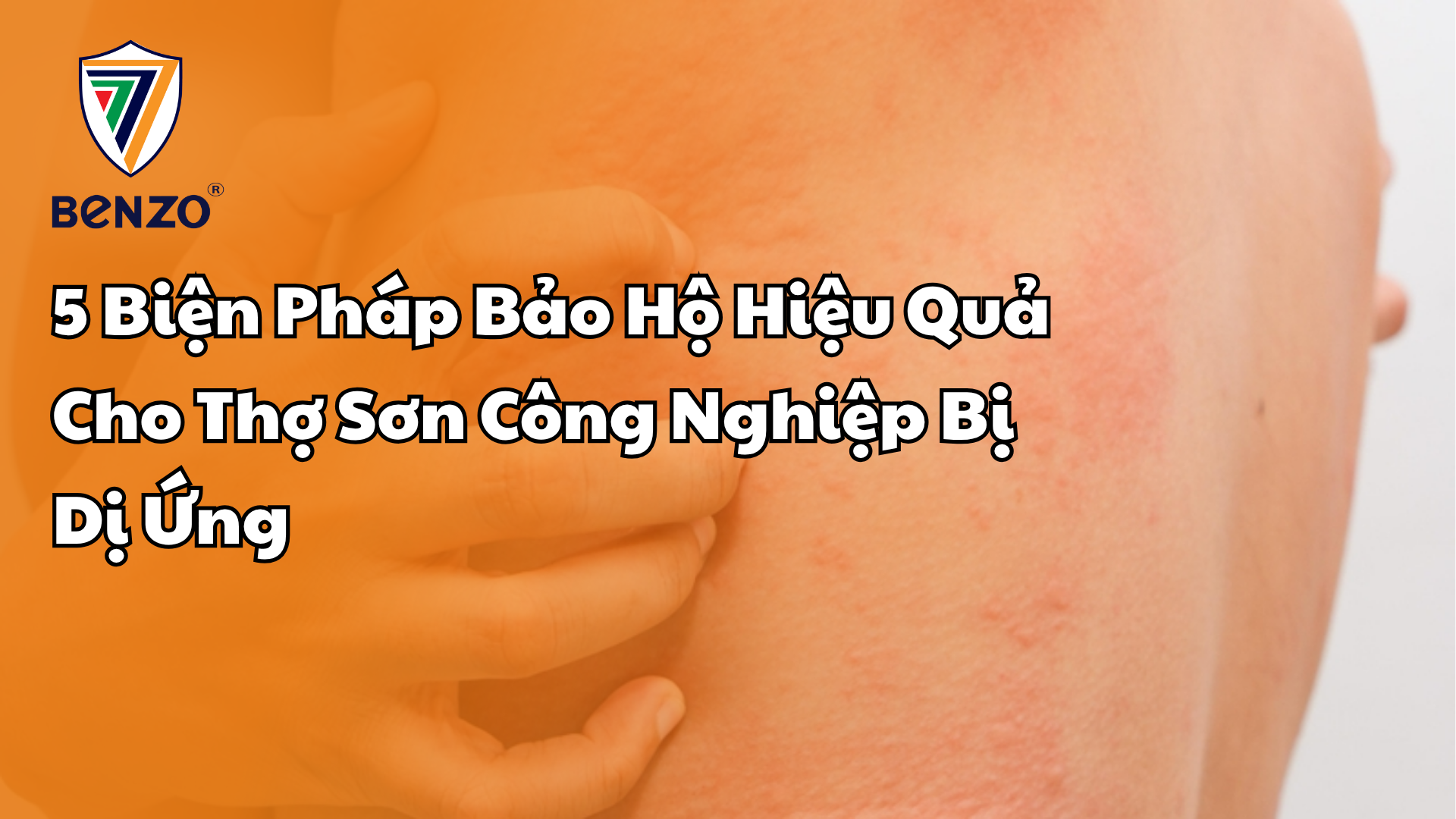 5 Biện Pháp Bảo Hộ Hiệu Quả Cho Thợ Sơn Công Nghiệp Bị Dị Ứng